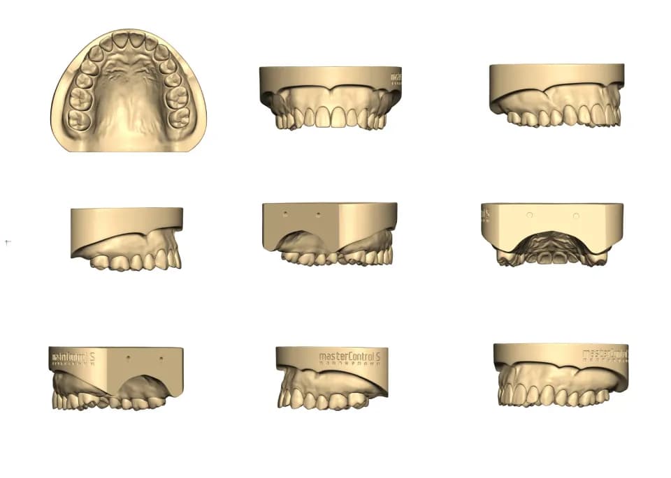 Dental model, Workshop photography