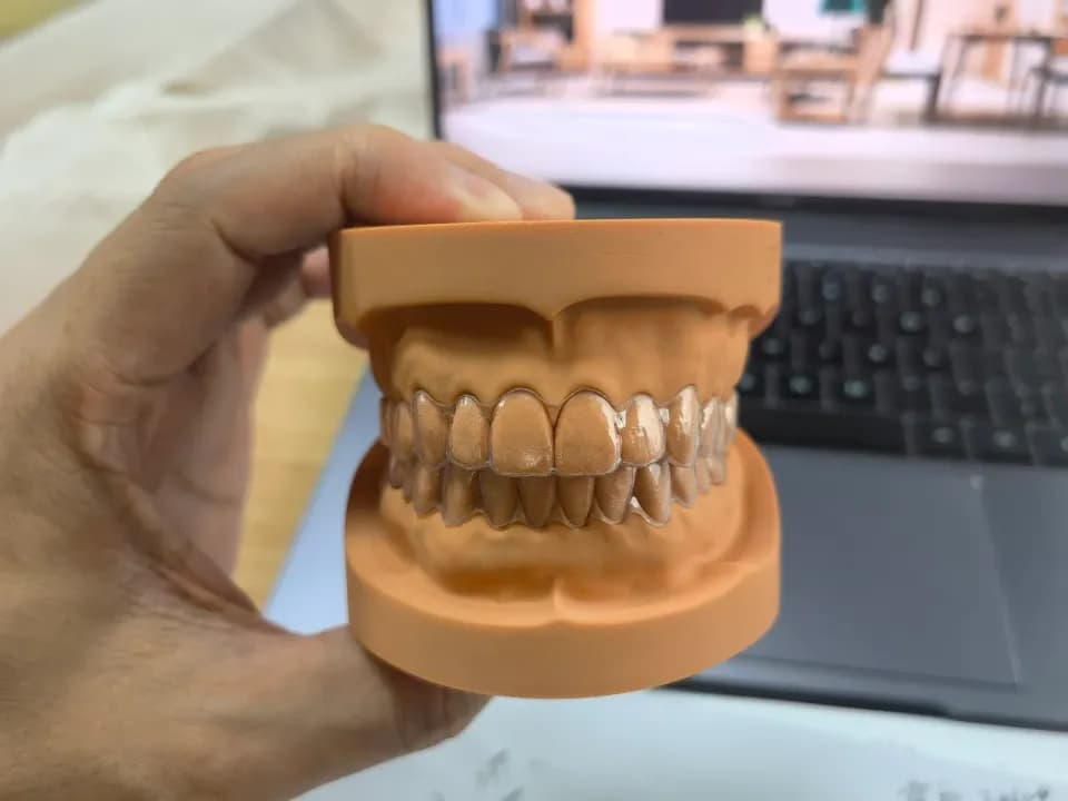 齿科模型，工程实拍